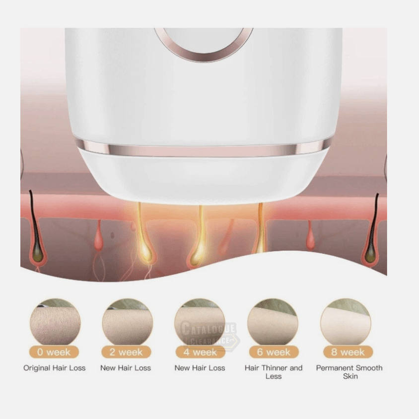 Fezax IPL Hair Removal Device – Painless, Permanent Hair Reduction System with Flash Technology